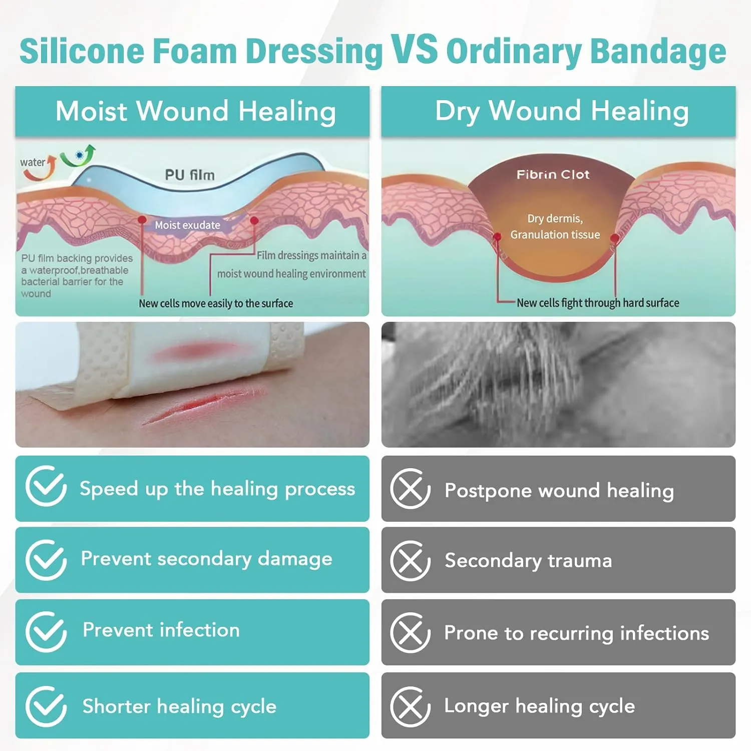 Silicone Foam Dressing with Adhesive Border 6“ x 6”,10 Packs Waterproof Silicone Bandages for Wounds Care, Large Self Adhesive Wound Dressing Bandage for Bed Sore, Silicone Foam Pad, FSA HSA Eligible
